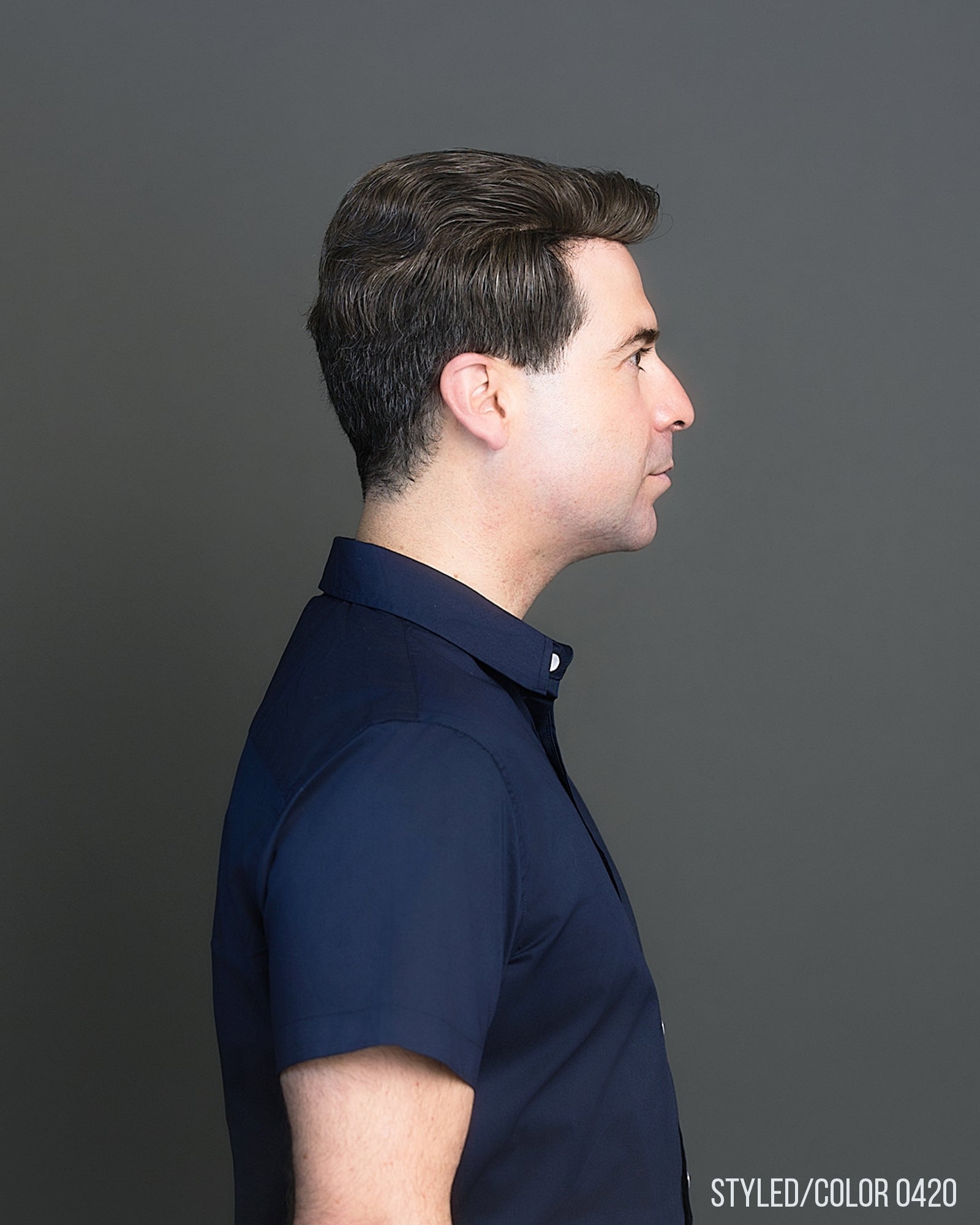 401 Men's System H by WIGPRO: Mono-top Human Hair Topper